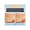 Crema Cicatricial De Minimizar Y Reducir Las Cicatrices 20g