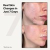 MILDLAB [MILDLAB]Centella Oint Cream 30g