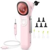 ScopeAround 3.9mm Otoscope 720p HD Smart Visual Ear Scope Camera