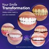Teeth Whitening Strips for Sensitive Teeth, Professional Strength Whitener, Enamel