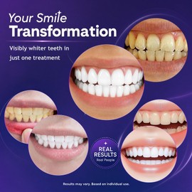 Teeth Whitening Strips for Sensitive Teeth, Professional Strength Whitener, Enamel Safe & Non-Slip, Removes Coffee Tea Smoke Stains, 28 Strips