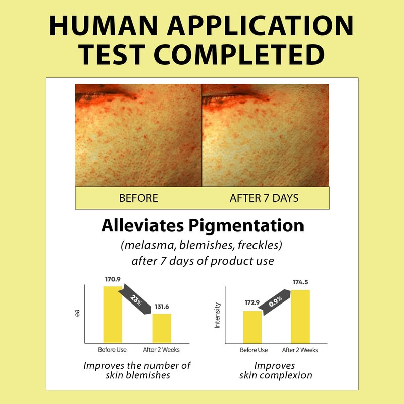 AMPLE:N [AMPLE:N]Blemi Shot Ampoule 50ml