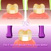 T.Smile Evolutionary Clean - Hilo dental (100 cabezales de recambio