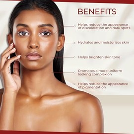 NEOPROSONE Crema Despigmentante Antimanchas con Alfa Arbutina y Aceite de Ricino, Corrector de Tono para Rostro, Axilas, Talones y Rodillas, 50ml