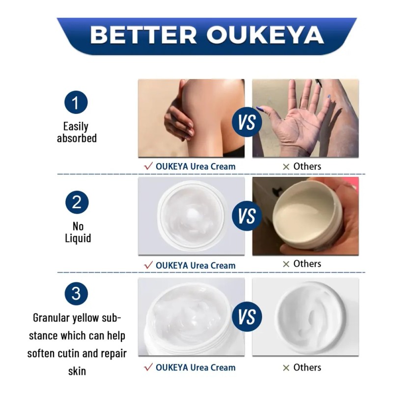 Urea Cream 42% Plus Salicylic Acid 2% Net 350g For