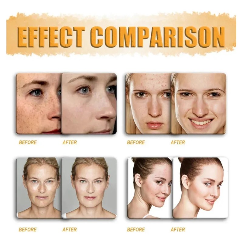 - Jabón Abrillantador Con Limón, Cúrcuma Y Ácidos Kójicos