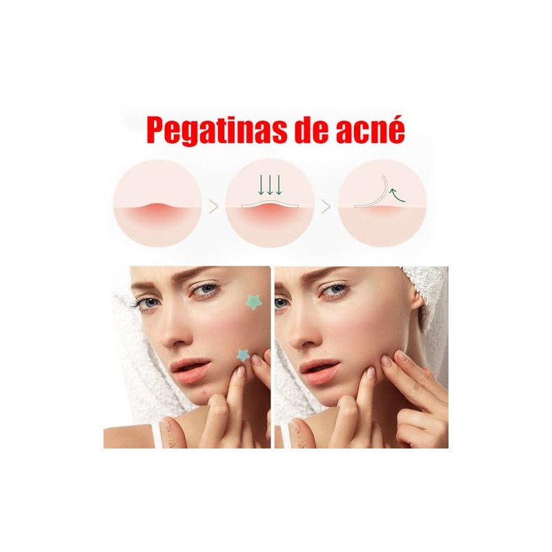 LUHI 200PCS Parches para Acne, Pimple Patch, Parches para Espinillas