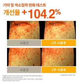 Adam Workshop 글루타치온 흑자 색소침착 미백 기미 멜라토닝 검버섯 비타민 크림 40ml 3+3 Glutathione Dark Spot Whitening Cream for Melasma and Pigmentation 40ml 3+3