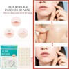 72 Parches Invisibles Cubrir y Eliminar Acne Espinillas Granos Imperfecciones