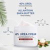 OUKEYA Urea Cream 40 Percent Urea Foot Cream for Dry