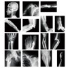Sayglossy 15 Pcs Broken Bones X Ray Set Human X