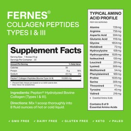Hydrolyzed Collagen Peptides Supplement for Women & Men - Joint, Hair, Skin & Nails Support - Grass Fed Type I & III - Keto, Paleo - 28 Servings, 9.88 oz, Unflavored Powder