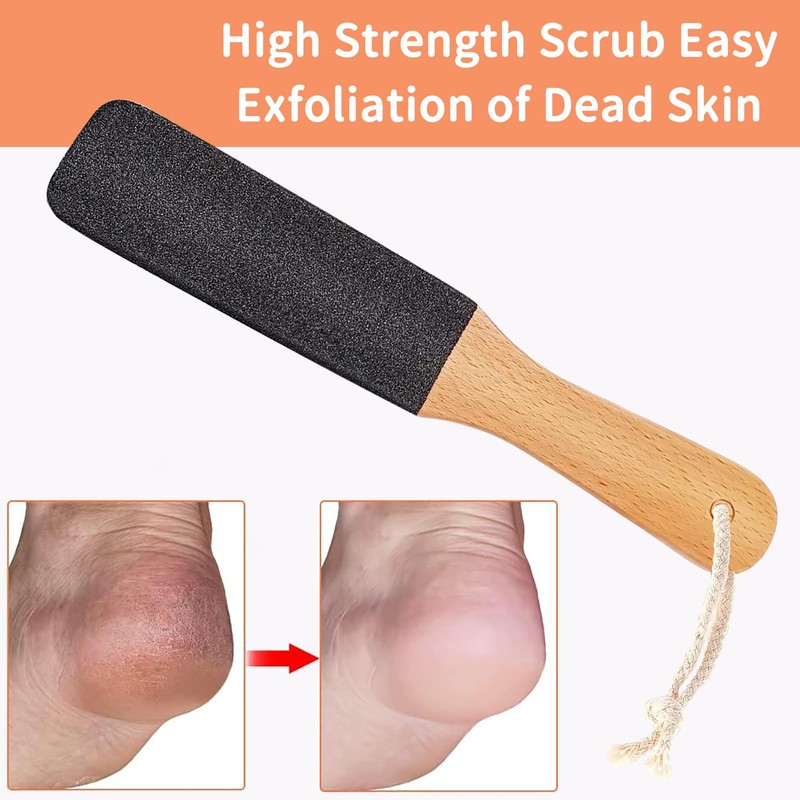 KIPTVO Pumice Stone for Feet, Hard Skin Remover Foot, Pedicure