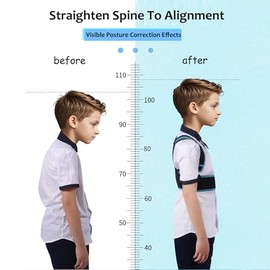 Corrector de postura para niños - Corrector de postura de espalda - Corrector de columna vertebral, soporte ajustable para la postura de la parte superior de la espalda, Previene la joroba en
