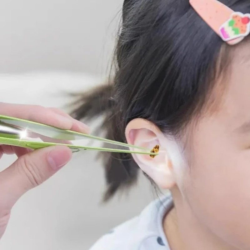 Stainless Steel Ear Tweezers with LED Light, Precision Earwax Remover,