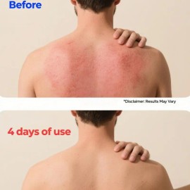 Plant-Based Herbal Skin Relief Cream, Natural Moisturizing Balm for Dry & Sensitive Skin, Daily Hydration Cream, Botanical Formula for Skin Comfort