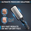 Foot File Callus Remover for Feet – Professional Heavy-Duty Hard