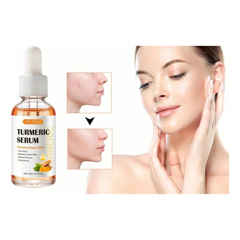 Jengibre Suero De Cúrcuma Para Manchas Oscuras