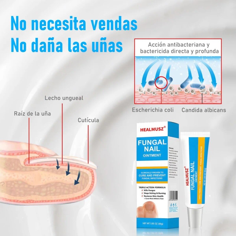 Crema De Uñas Antifúngico Para Uñas De Manos Y Pies