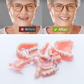 Gum Material - for Repairing Missing Teeth and Smile Improvement. Parts of Partial or Full Dentures