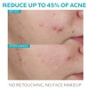 La Roche-posay Effaclar Pore-refining Anti-wrinkle Serum, 1.01 Fluid Ounce