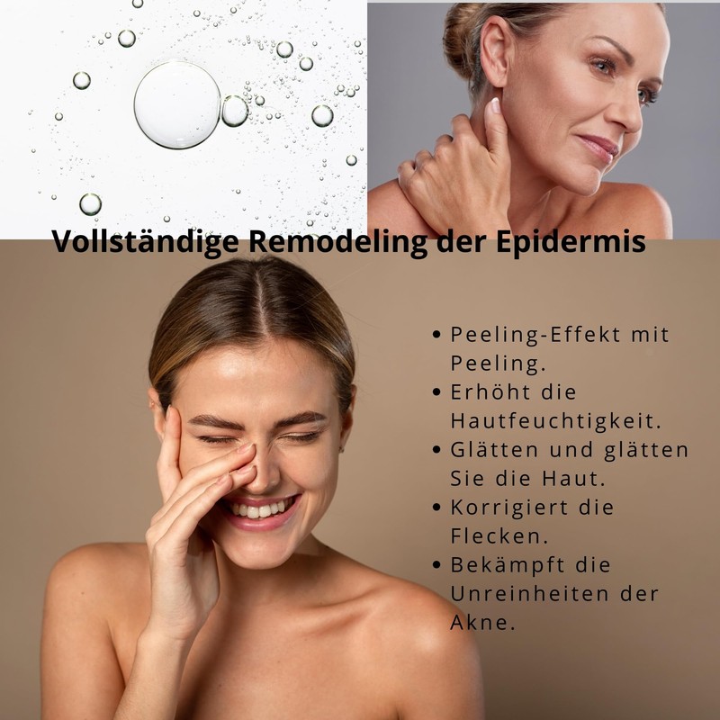 Glycolic Acid Exfoliation, Anti-Blemish and Acne Treatment, Smooth, Luminous Skin,