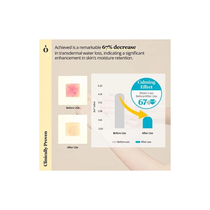 Ongredientes Skin Barrier Loción Calmante | Hidratante Liger