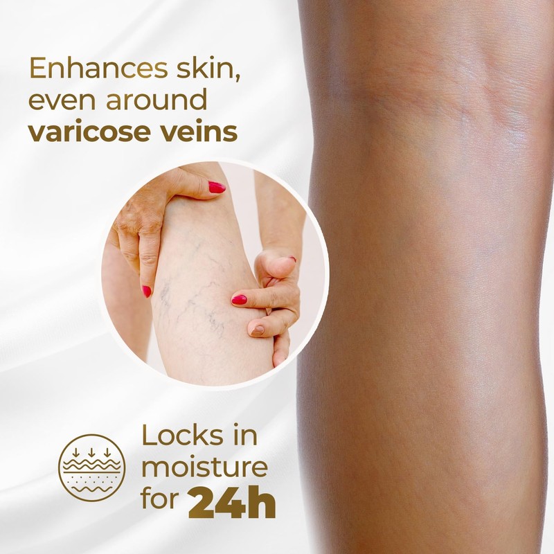 Goicoechea Arnica & Chamomile Body Lotion | Soothes Tired Legs;