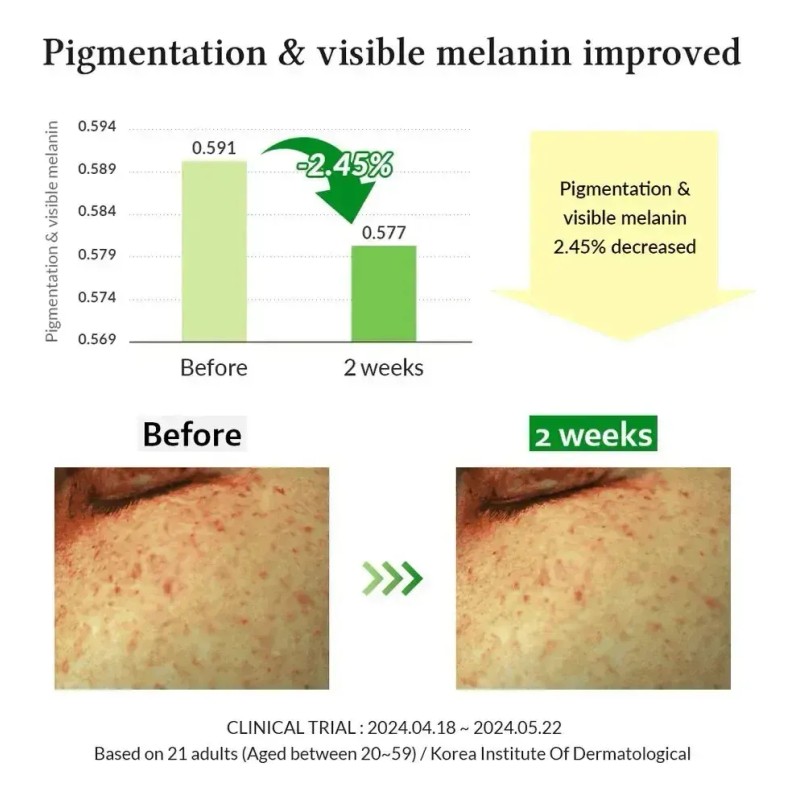 Serum Dr. Althea Vitamina C 20% Clarifying Antimanchas 30ml