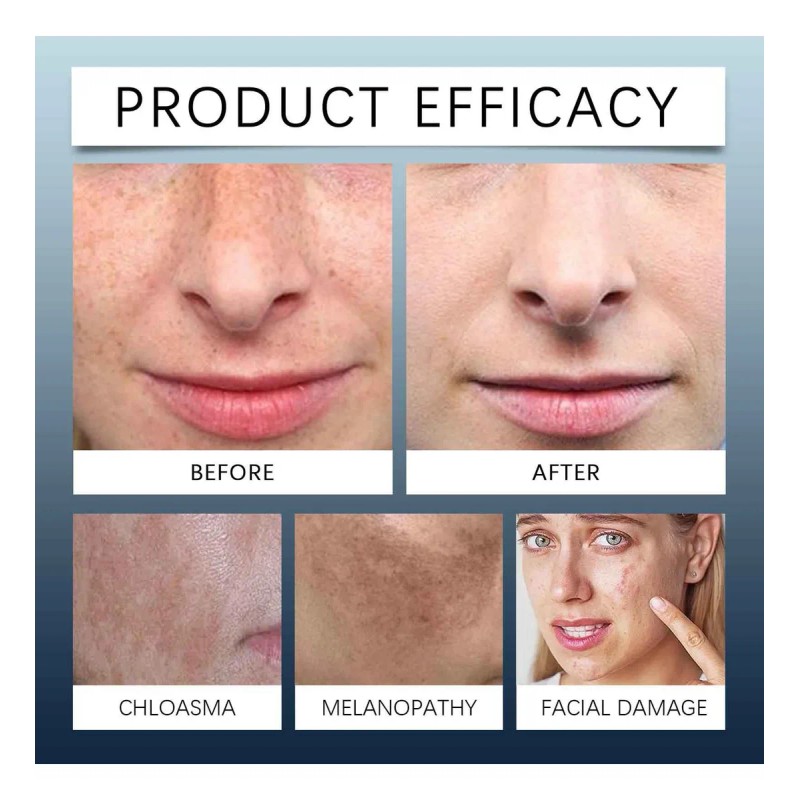 Crema Facial Para Todo El Día Y La Noche, Paquete