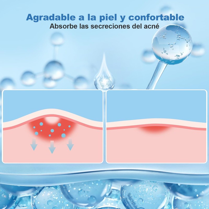 Parches para Acne,Pimple Patch,200 Almohadillas Hidrocoloides para Espinillas, Parches para