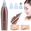 Rechargeable Electric Blackhead Removal Machine Vacuum Suction Face Pore CleanerChampagne