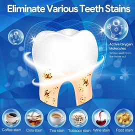 Whitening Teeth Stripes Whitening Strips: 7x Teeth Whitening Strips Whitening Teeth Gentle, 2x Tooth Bleaching Stripes, White Teeth Immediately, Celakeety White Stripes Teeth, Tooth Enamel-Safe, No