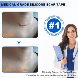Medical Grade Silicone Scar Tape for Scar Removal Reusable Scar Sheets for C Section Recovery Tummy Tuck Keloid Surgical Scars, Safe for Adults & Kids (1.6 "X 120")