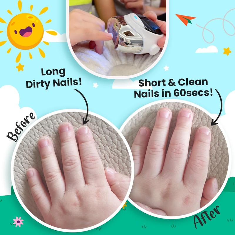 MyLO Electric Baby Nail Clipper Trimmer for 6mo+, Automatic Baby
