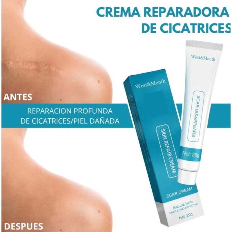 Crema Despigmentante Manchas Melasma Cicatrices Paño Y Acne