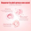 Loción Secante Antiacné Ácido Salicílico 10ml Oukeya
