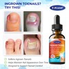 Ingrown Toenail Relief: Ingrown Toenail Tool for Men Women -