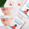 144 Parche Adhesivos Para Imperfecciones Piel Acné Verrugas