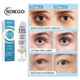 Retinol Caffeine Eye Serum Retinol Eye Firming Serum for Dark Circles and Puffiness A...