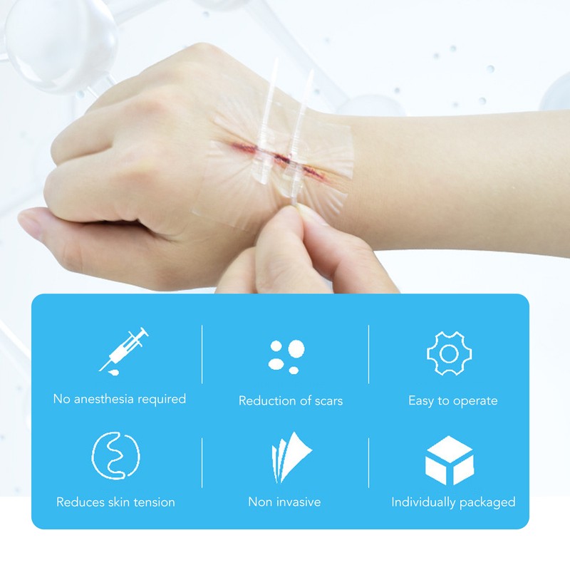 1pcs Emergency Wound Closures Adhesive Seamless Cuttable Hygienic Zip Stitch
