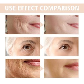 Retinol Collagen Cream for Face With 5% Hyaluronic Acid,Face Cream for Women,Retinol Face Cream With Collagen,Retinol Serum for Face,Anti-Aging Retinol Cream,Anti Wrinkle Face Cream,Night Moisturiser