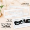 Keababies Baby Sonogram Picture Frames - Trio Ultrasound Pic