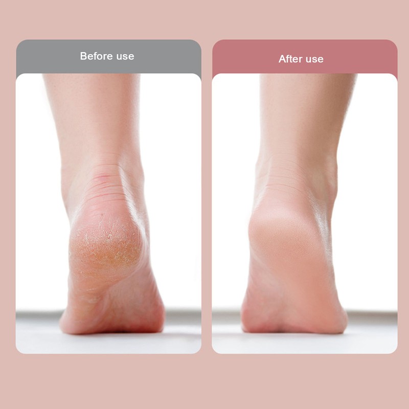 Detachable Washable Foot File USB Waterproof Callus Remove Rechargeable Foot