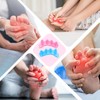 LUMOOM 4 Stück Zehenseparatoren, Hallux Valgus Korrektur, Wiederverwendbare und Waschbare
