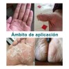 Artken Reparación Para Pies Agrietados Y Resecos - Crema T