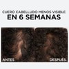 LOreal Paris Serum Capilar Caída Resist con Aminexil Elvive 102ml.
