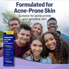 TARO- "Gel para el tratamiento del acné Taro Adapalene 0,1%