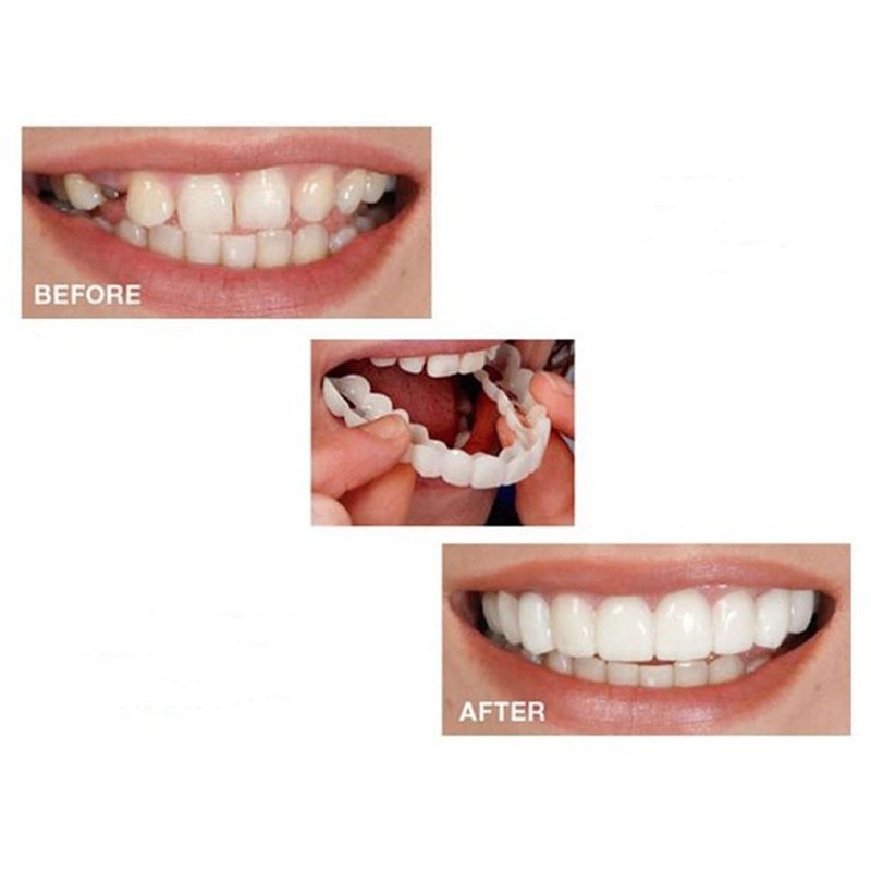 2 Pairs, Temporarily Adjustable for Men and Women, Regain Confidence