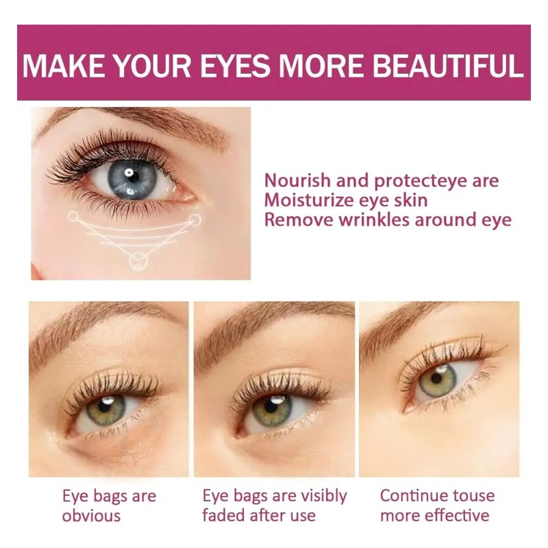 Crema De Ojos Reductora De Arrugas Y Arrugas Q Antis
